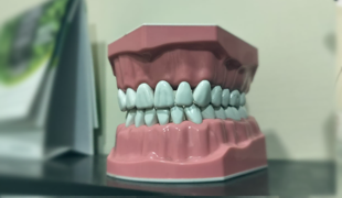 Dental treatment by Dr Prabhuta Baghel